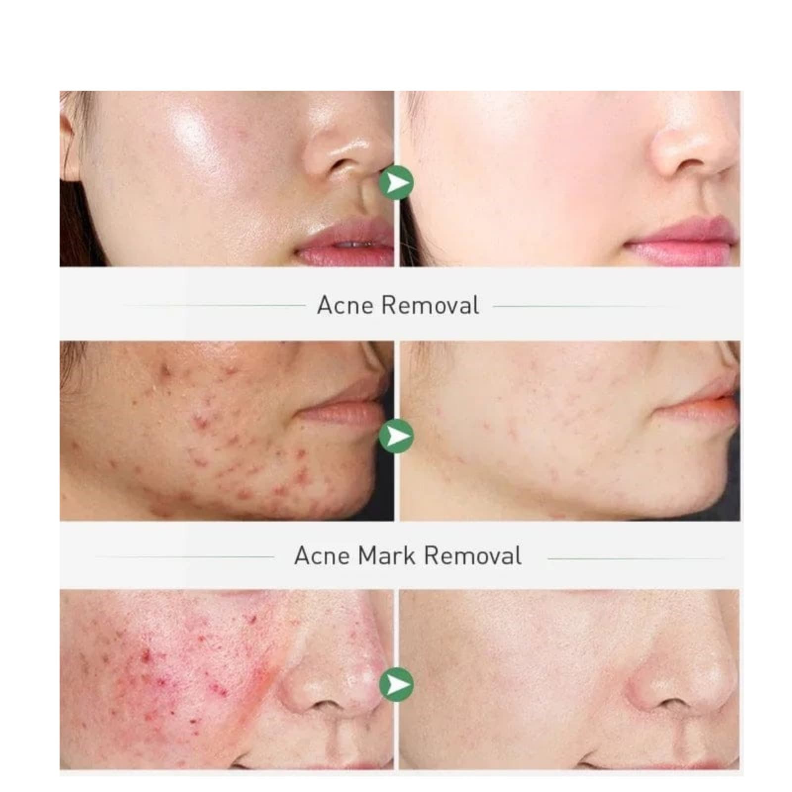 Face Whitening Cream view 4